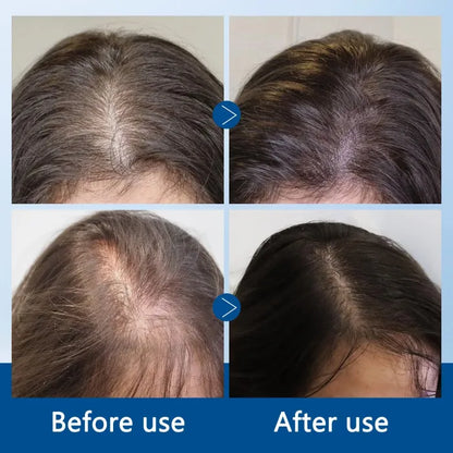 Hair Growth Serum Roll On