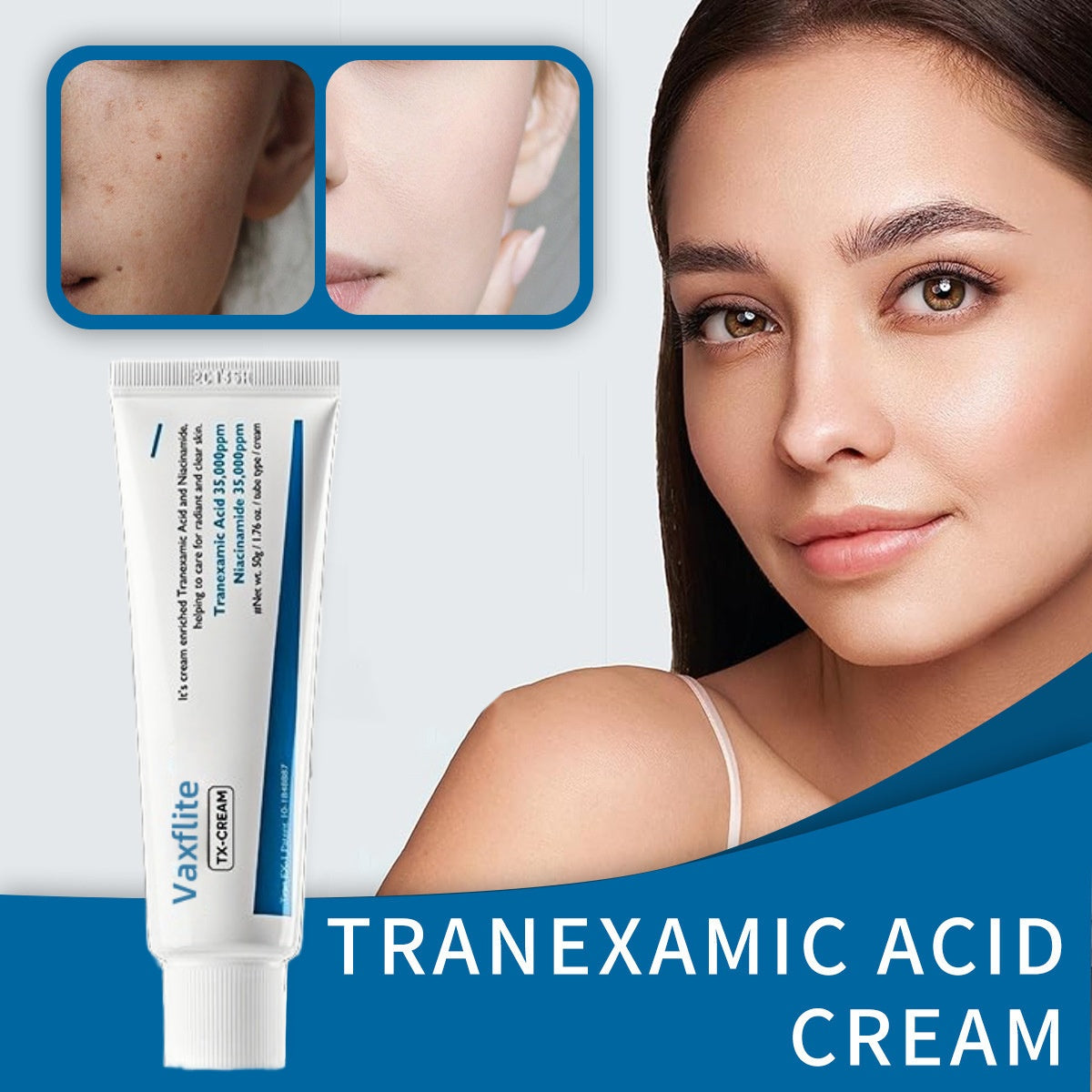 🍃Blizkox™-TX Cream 50ml｜🔥Nano-sized Tranexaminc Acid for Dark Spots & Hyperpigmentation✨